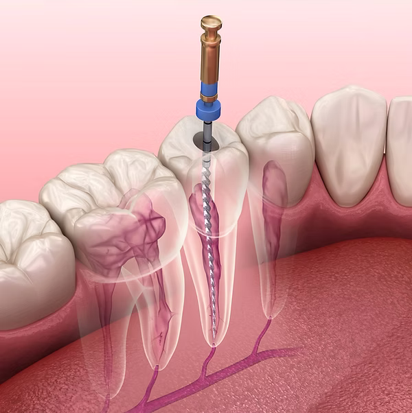 Root Canal Microscope